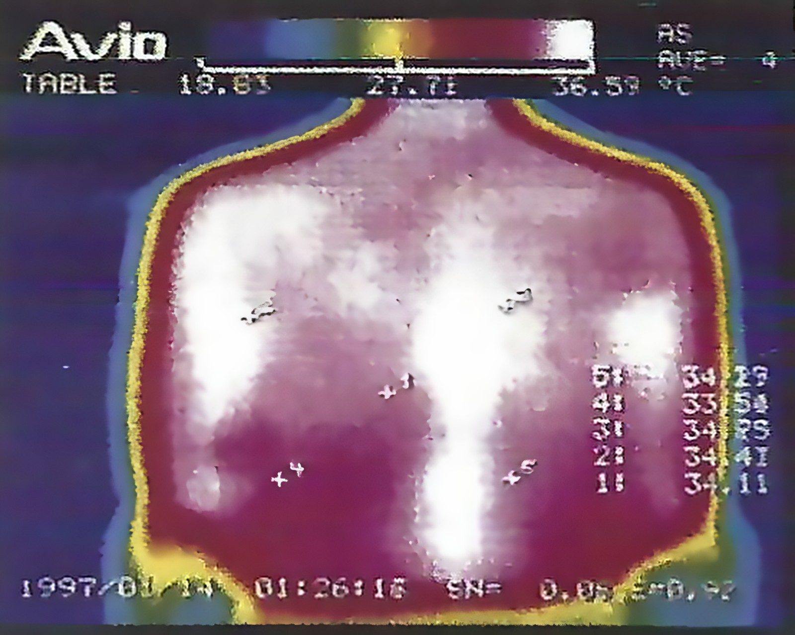 원적외선 투과 후 상태 After Extreme infrared radiation